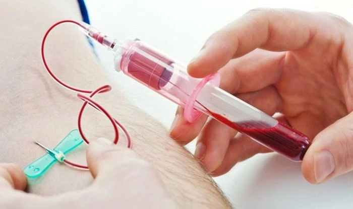 Xét nghiệm máu trong khám sức khỏe định kỳ: Cần lưu ý gì?