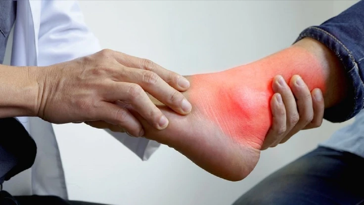 4 sai lầm thường gặp khi điều trị bệnh gút