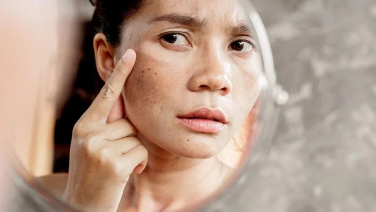 5 dấu hiệu da bị lão hóa và cách khắc phục