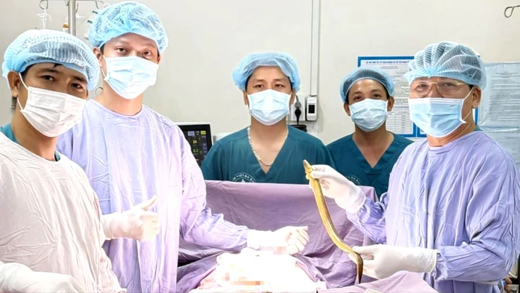 Phẫu thuật lấy con lươn dài khoảng 50cm chui trong bụng người đàn ông 