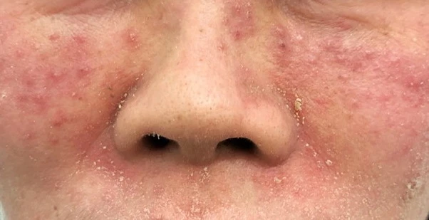  Làm đẹp cấp tốc đón Tết, nhiều người 'tiền mất tật mang'