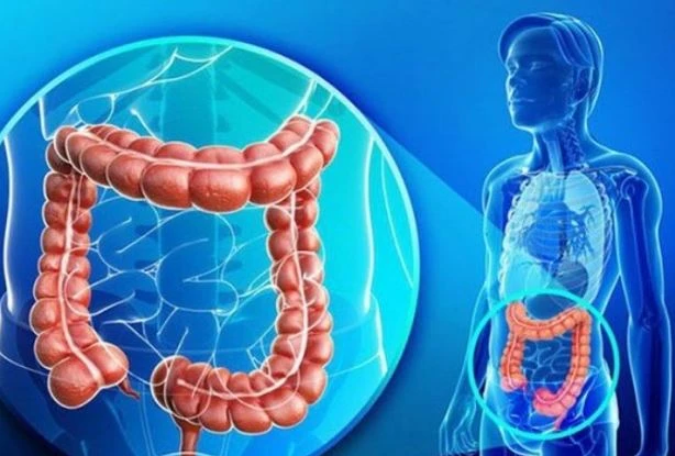 Hội chứng ruột kích thích có chữa khỏi được không?