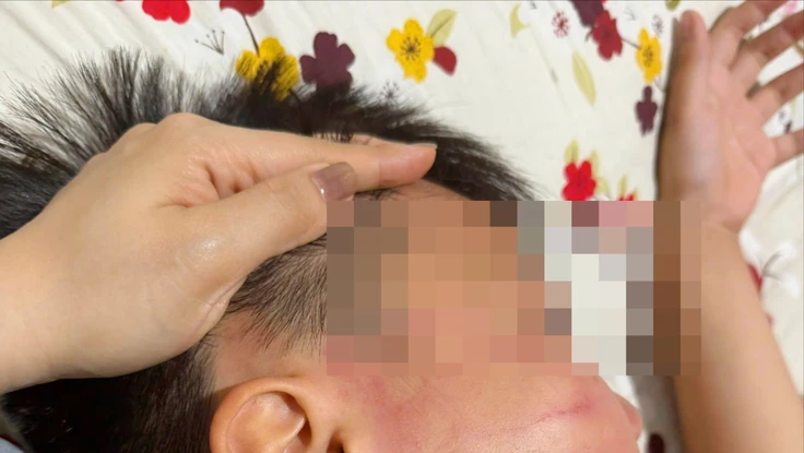 Công an xác minh vụ học sinh lớp 4 bị giáo viên dạy thêm tiếng Anh tát vào mặt