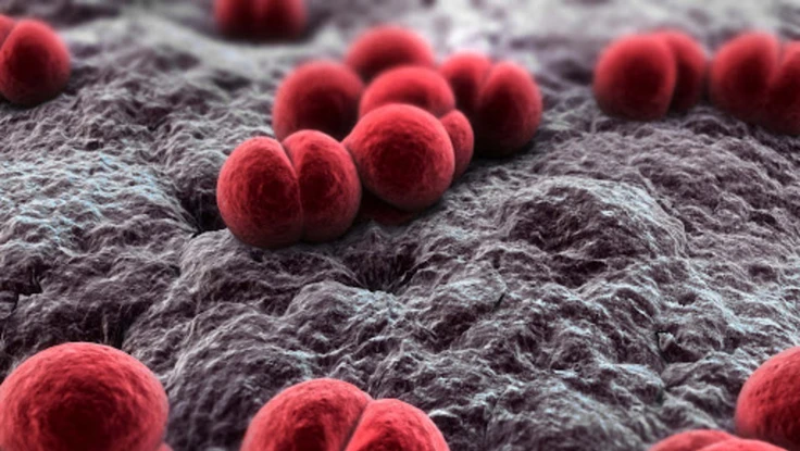 Biến chứng nguy hiểm của não mô cầu