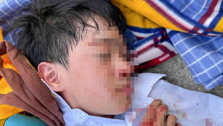 Công an thông tin về việc 1 học sinh lớp 6 bị tấn công