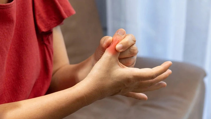 5 cách giảm nồng độ axit uric tự nhiên và ngăn ngừa đau khớp hiệu quả