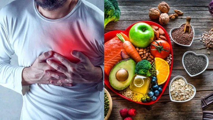 Thực phẩm nên ăn và nên tránh để tránh đau tim tái phát 