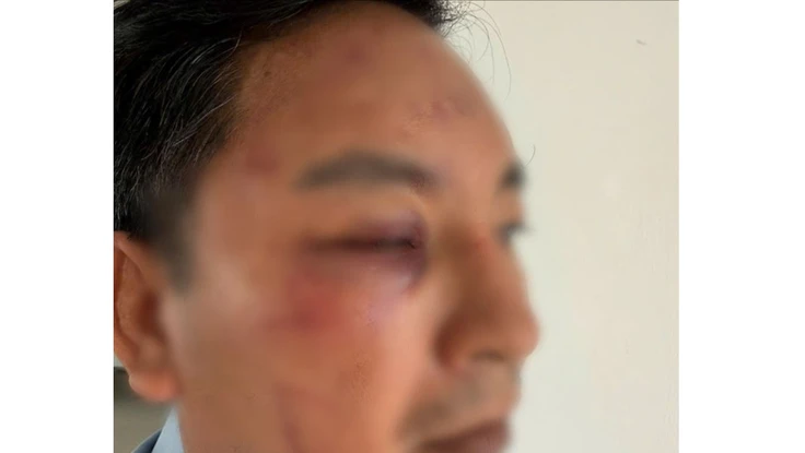 Công an Đồng Nai đang điều tra vụ 3 người xông vào đánh, nổ súng do mâu thuẫn nợ nần