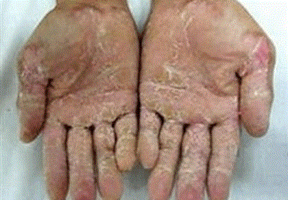 Khám, sàng lọc miễn phí cho người dân mắc 'bệnh lạ'