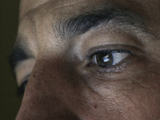 Giun dài 15cm ngoe nguẩy trong mắt cụ 75 tuổi ảnh 1