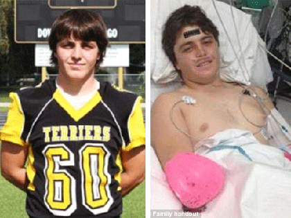 Tắm sông, cậu bé bị cá sấu cắn đứt cánh tay phải! ảnh 1