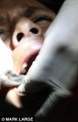 Bị phản bội, nữ nha sĩ nhổ sạch răng người yêu ảnh 1 Bị phản bội, nữ nha sĩ nhổ sạch răng người yêu ảnh 1