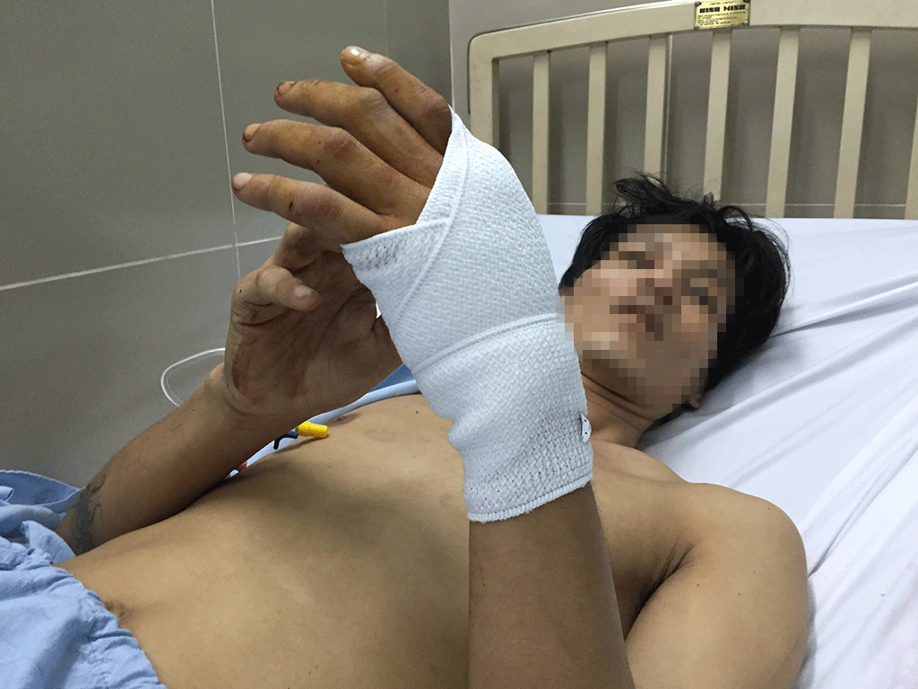 Sức khỏe của nạn nhân hiện đang hồi phục tích cực.