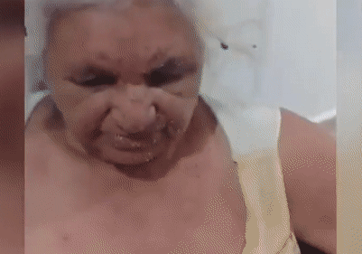 3 cụ bà đi câu cá bị ong đốt thương tâm