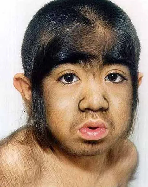 Ảnh minh họa. Nhung can benh ky la nhung co thuc hinh anh 1