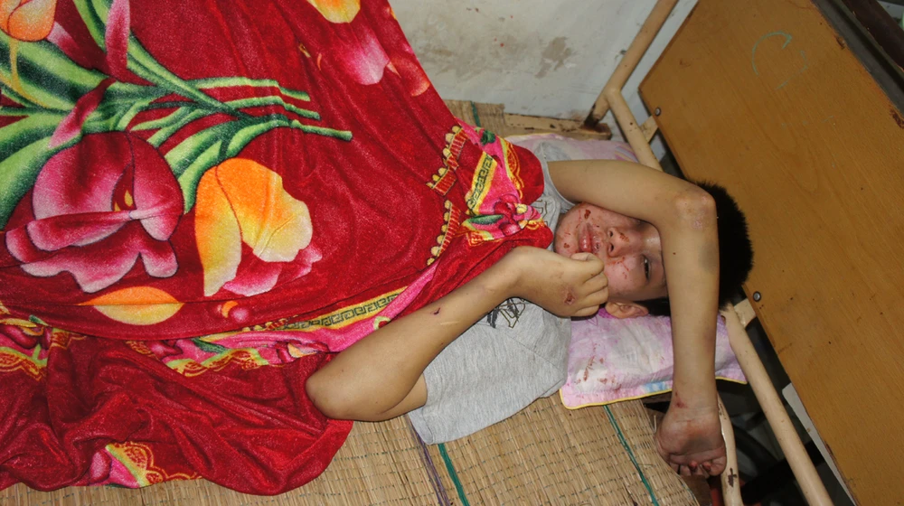 Giải cứu bé trai khuyết tật bị bắt cóc, đánh đập, đốt dã man ảnh 1