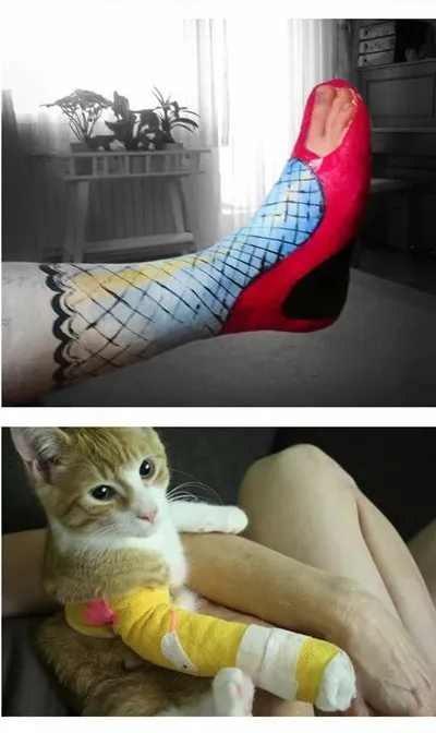 Nghệ thuật trên những cánh tay gãy ảnh 14