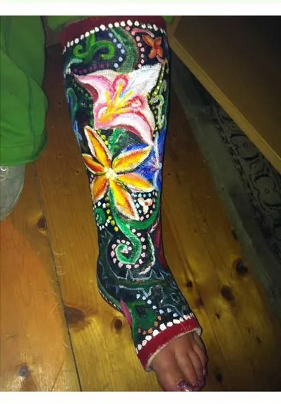 Nghệ thuật trên những cánh tay gãy ảnh 18