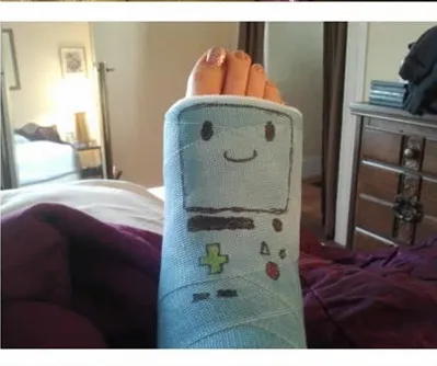 Nghệ thuật trên những cánh tay gãy ảnh 17