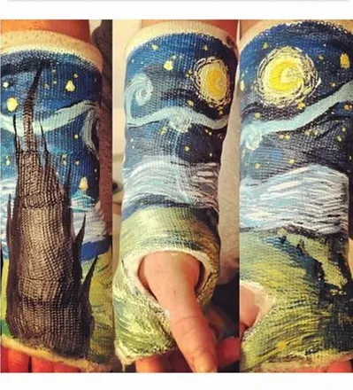 Nghệ thuật trên những cánh tay gãy ảnh 26