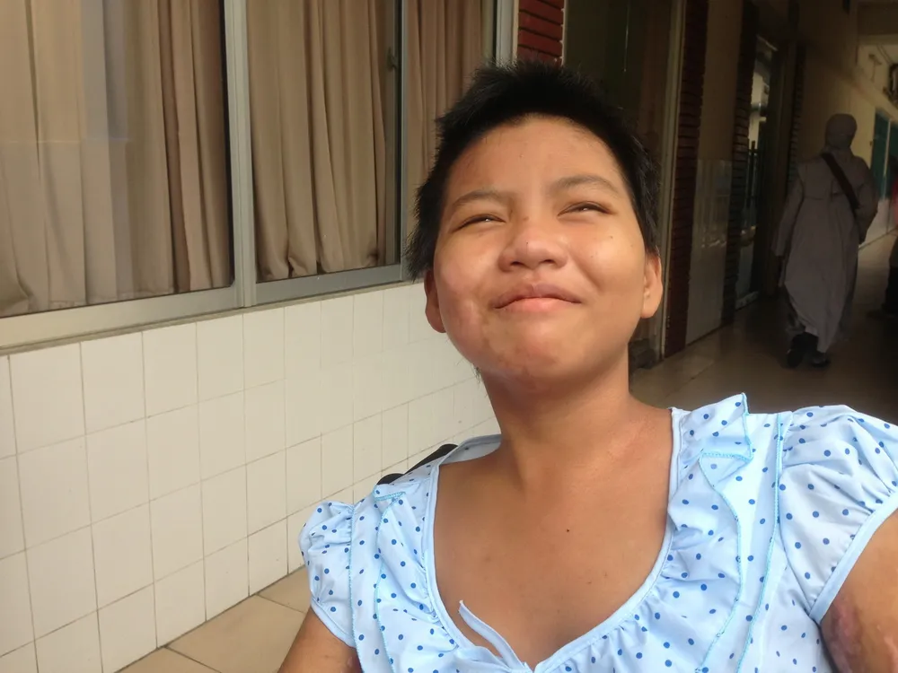 Bé gái bị mẹ tưới xăng đốt cười tươi khi xuất viện ảnh 3