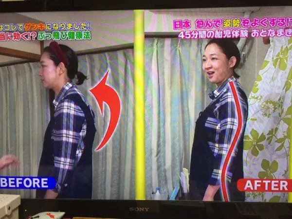 Phương thức trị liệu 'có một không hai' của người Nhật ảnh 3