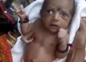 Chú bê một mắt kì lạ được tôn thờ như một vị thần ảnh 2 Bé gái sinh ra có 3 bàn tay được tôn thờ như vị thần