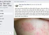 Dân Đà Nẵng lo lắng khi cứ tắm biển là ngứa
