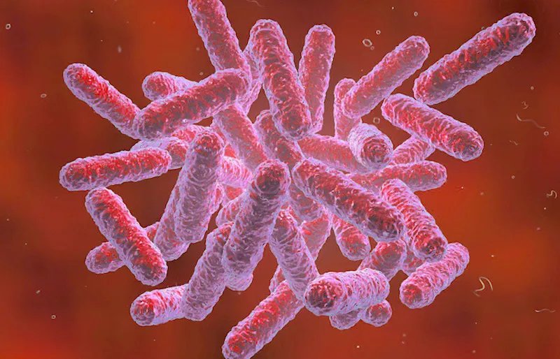 Bệnh Whitmore gây ra bởi vi khuẩn Burkholderia pseudomallei. (Ảnh minh họa) benh-Whitmore.jpg