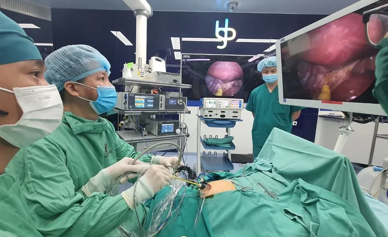 mổ nội soi điều trị nang ống mật chủ.png