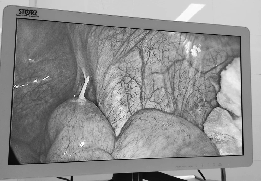 nuốt tăm tre 4cm.jpg