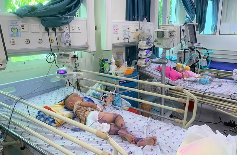 Nhiều trẻ mắc tay chân miệng cấp độ nặng ở TP.HCM phải nhập viện điều trị. Ảnh: THẢO PHƯƠNG tay chân miệng.png