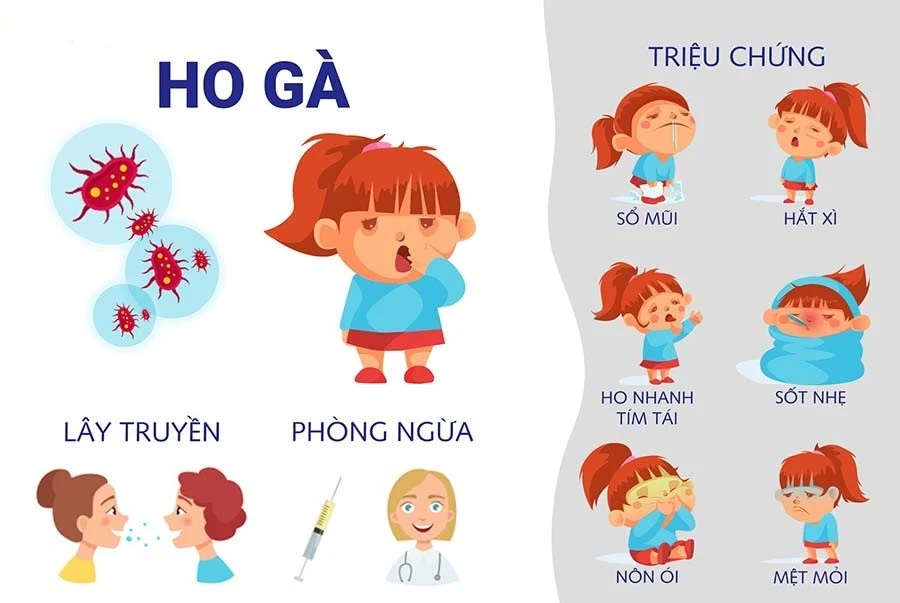 Bệnh ho gà có khả năng lây lan nhanh qua đường hô hấp. Ảnh minh họa ho gà.jpg