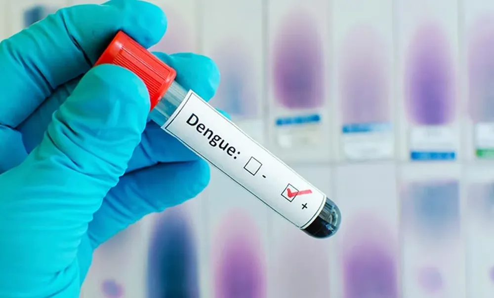 Việt Nam lần đầu cấp phép sử dụng vaccine sốt xuất huyết. (Ảnh minh họa) vaccine sốt xuất huyết.png