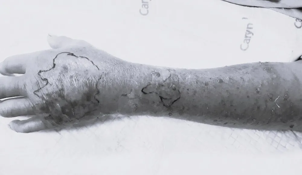 trẻ 3 tuổi cắn.jpg