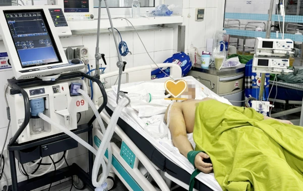 Nam thanh niên nhập viện trong tình trạng hôn mê sâu, phải thở máy, lọc máu. Ảnh: BVCC sốc nhiệt.png