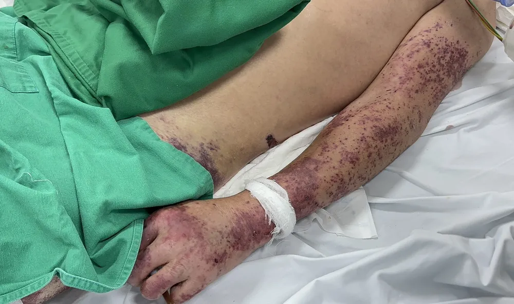 chế biến thủ lợn.jpg