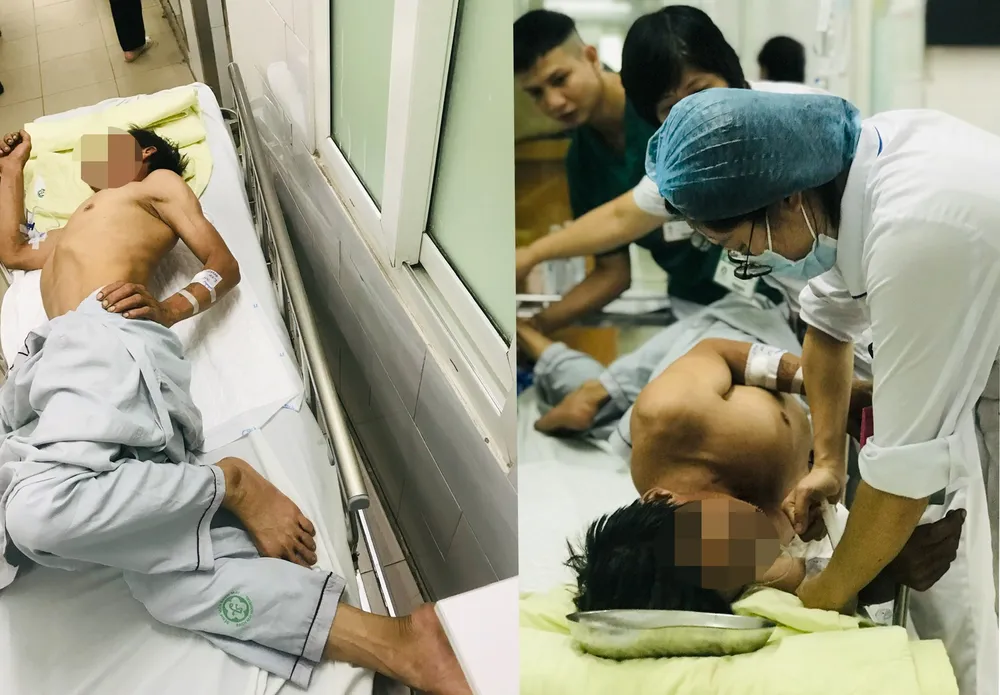 bệnh uốn ván.jpg