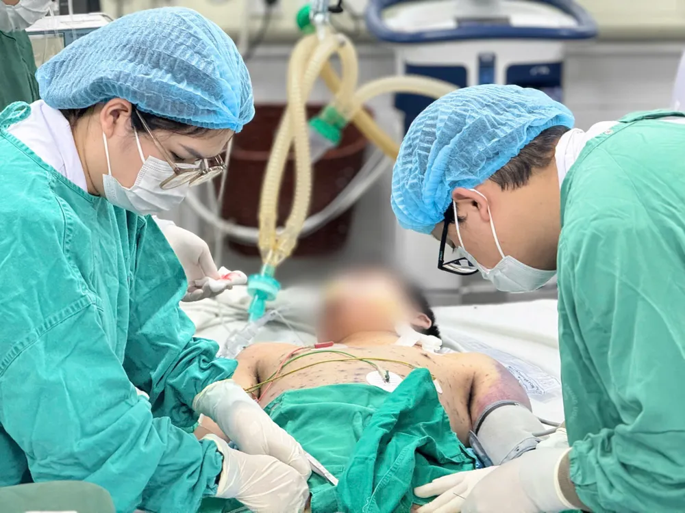 nguy kịch do mắc thủy đậu