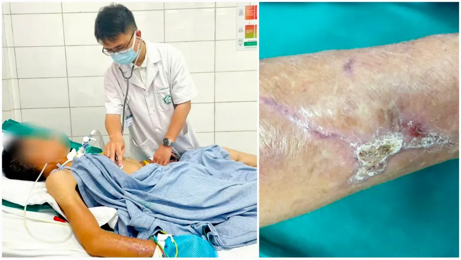 bệnh uốn ván 1.png