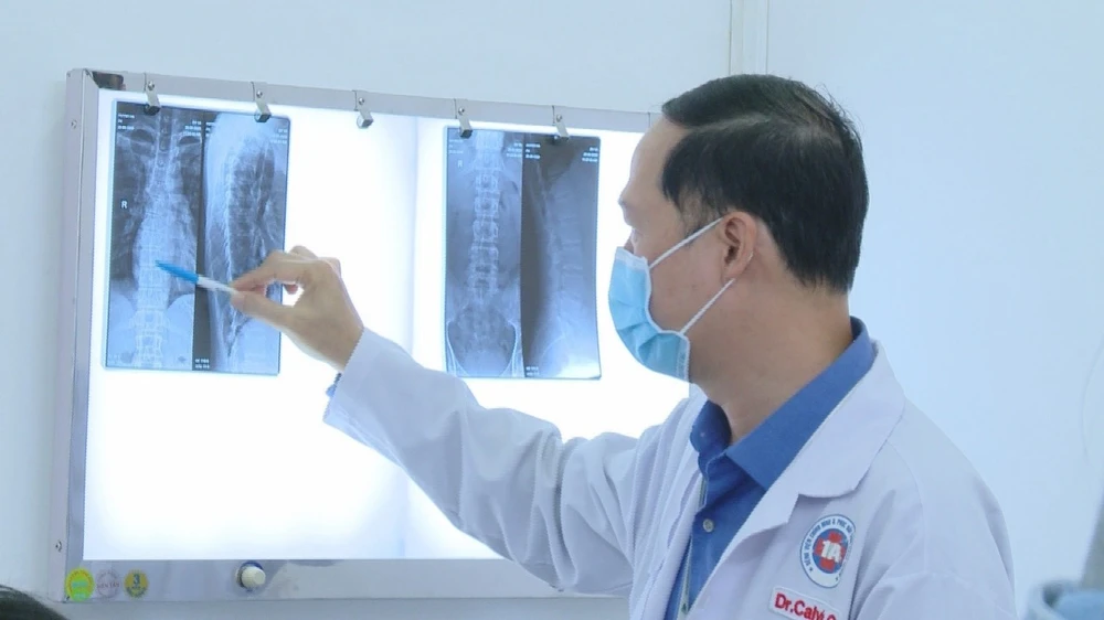 Trên phim X-quang, bệnh nhân bị tổn thương các đốt sống và gãy xương sườn. Ảnh: BSCC