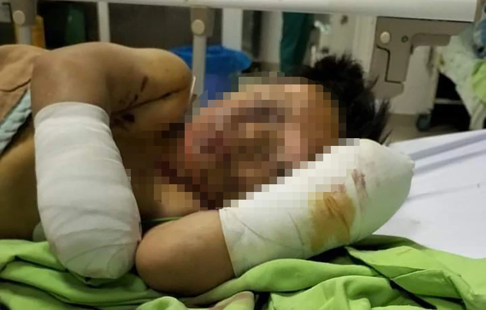 PĐC đang cấp cứu ở bệnh viện. Ảnh: TD