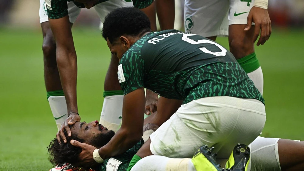 Đồng đội sơ cứu cho Al Shahrani ngay trên sân. Ảnh: AFP