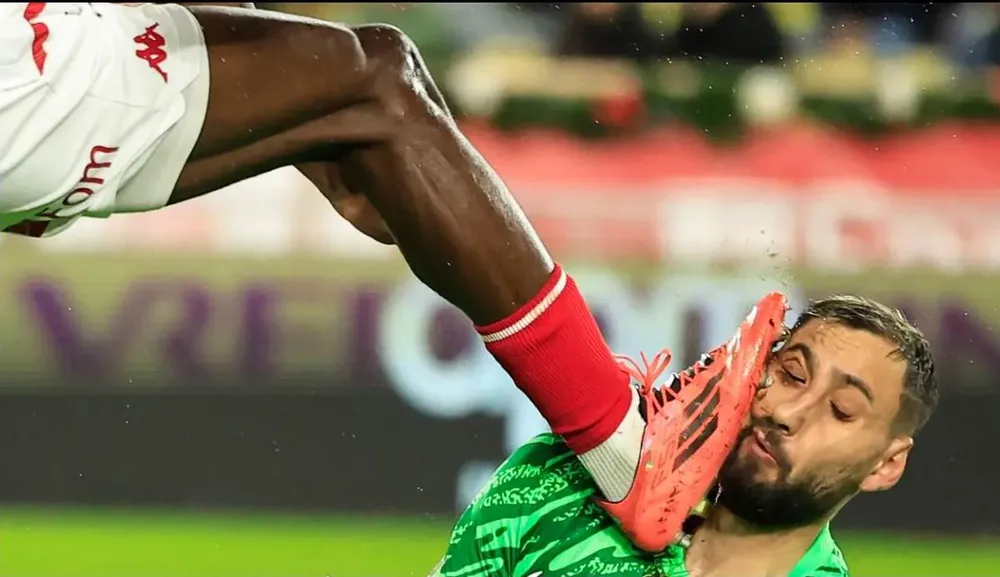 Donnarumma bị chấn thương