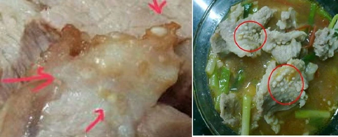 Động kinh, mù mắt vì sán gạo làm tổ trên da ảnh 2