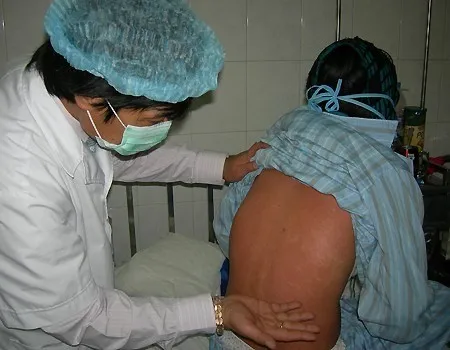 Xuất hiện ổ dịch rubella tại Bình DBình Dương: Phát hiện ổ dịch rubella trong khu lưu trú công nhân ảnh 1 Xuất hiện ổ dịch rubella tại Bình DBình Dương: Phát hiện ổ dịch rubella trong khu lưu trú công nhân ảnh 1