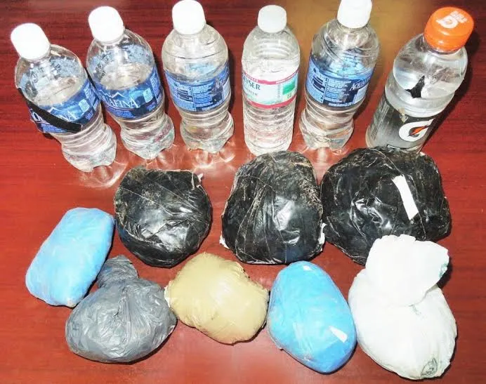 Rùng mình: 20 dạng vật lạ trong cơ thể người ảnh 9