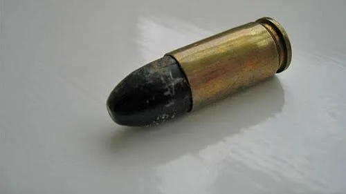 Rùng mình: 20 dạng vật lạ trong cơ thể người ảnh 16