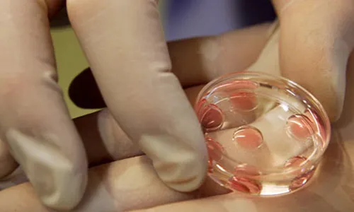 Điều kiện tham gia chương trình thụ tinh ống nghiệm miễn phí ảnh 1