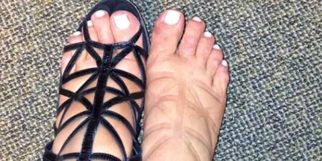 8 trang phục, phụ kiện ngấm ngầm hủy hoại sức khỏe ảnh 3